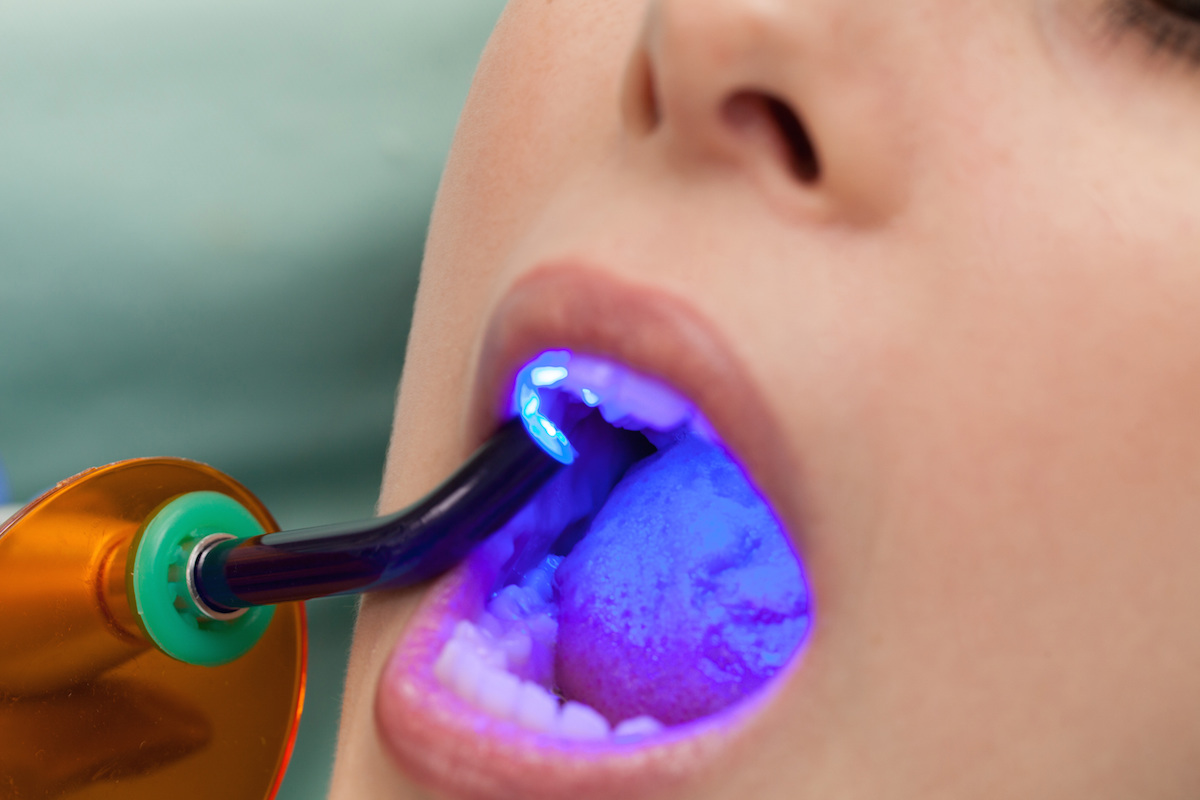 odontologia preventiva Odontología conservadora