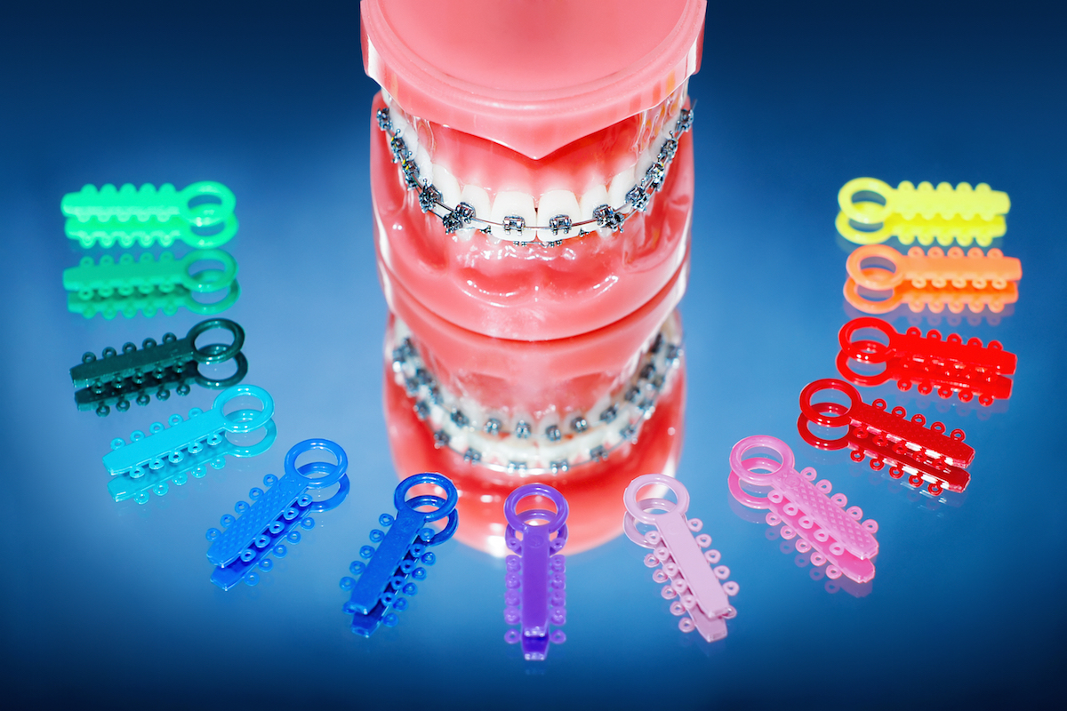 ortodoncia infantil Odontopediatría
