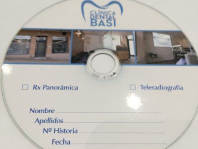 ORTOPANTO Ortopantomografia y teleradiografia en Clínica Dental Basi