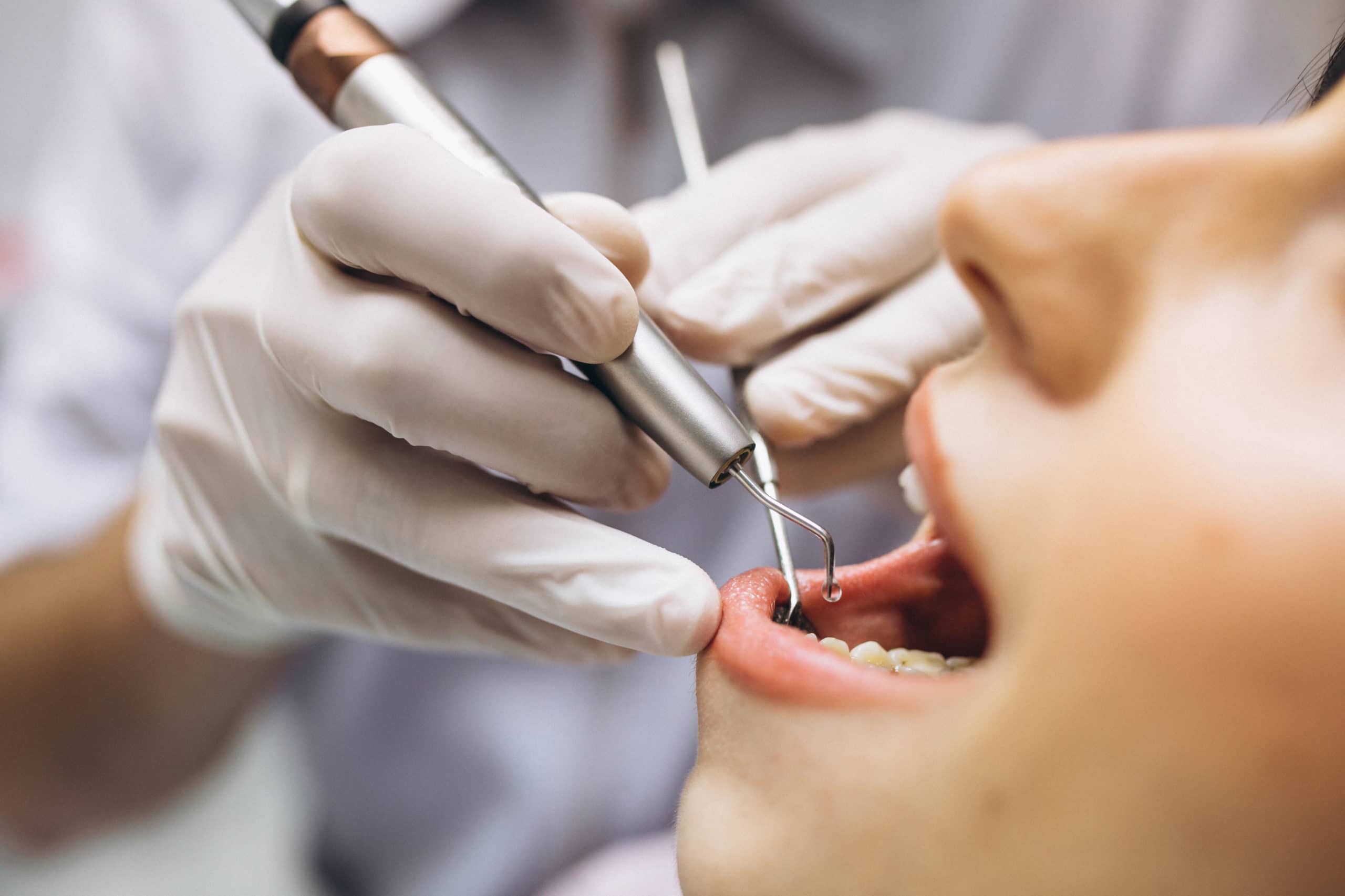 woman patient dentist scaled La periodontitis, la salud de la encías y el coronavirus